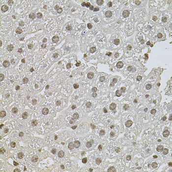 Anti-ZNF408 Polyclonal Antibody (CAB8512)