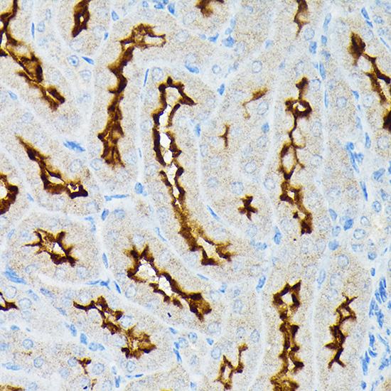 Anti-ACE2 Antibody (CAB12737)