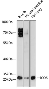 Anti-ICOS Antibody (CAB1811)