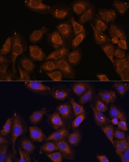 Anti-UPF1 Antibody (CAB1521)