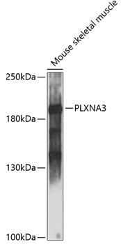 Anti-PLXNA3 Antibody (CAB14908)