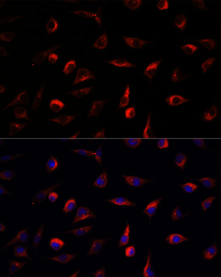 Anti-MAP2K7 Antibody (CAB2186)