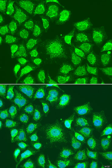 Anti-ATG4D Antibody (CAB7842)