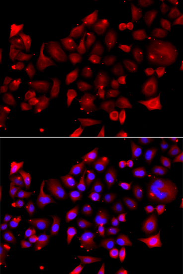 Anti-RRM2B Polyclonal Antibody (CAB8020)