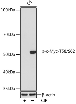 Anti-Phospho-c-Myc-T58/S62 Antibody (CABP0988)