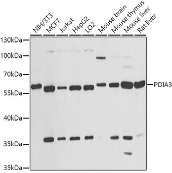 Anti-PDIA3 Antibody (CAB1085)