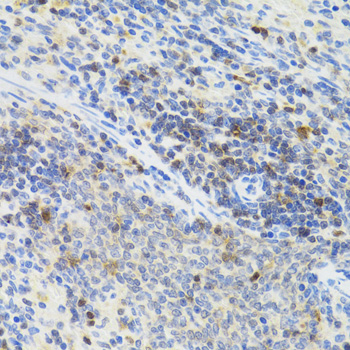 Anti-STAT4 Antibody (CAB6991)