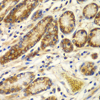 Anti-CAPNS1 Antibody (CAB6539)