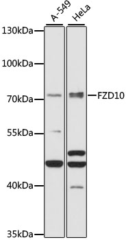 Anti-FZD10 Antibody (CAB15399)