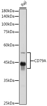 Anti-CD79A Antibody (CAB0331)