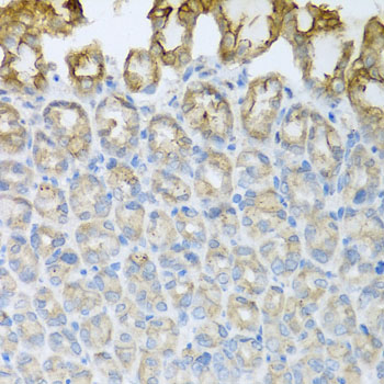 Anti-CXCR4 Antibody (CAB12534)