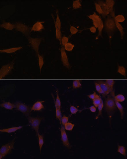 Anti-PRKAB2 Antibody (CAB6952)