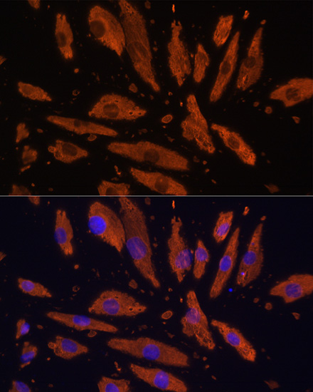 Anti-SIRPA Polyclonal Antibody (CAB9001)