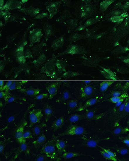 Anti-CGRP Antibody (CAB5542)