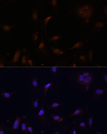 Anti-TET3 Antibody (CAB7612)