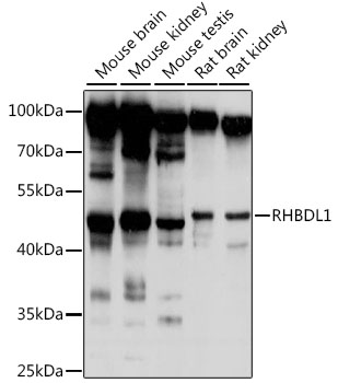 Anti-RHBDL1 Antibody (CAB16084)