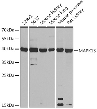 Anti-MAPK13 Antibody (CAB16961)