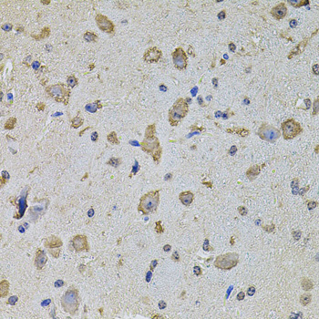 Anti-EIF4A2 Antibody (CAB3849)