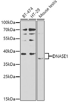 Anti-DNASE1 Antibody (CAB2537)