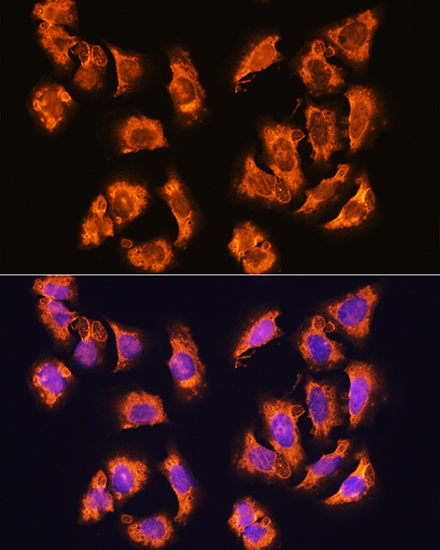 Anti-SGCA Antibody (CAB4109)