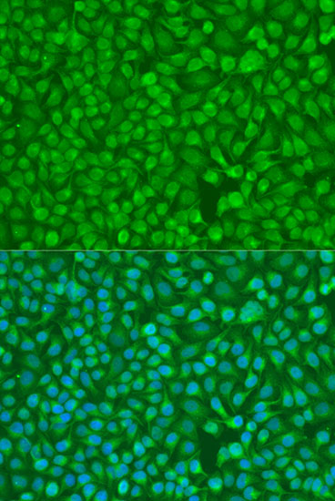 Anti-Chk1 Antibody (CAB7653)