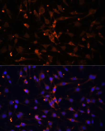 Anti-AMPKAlpha2 Antibody [KO Validated] (CAB7339)