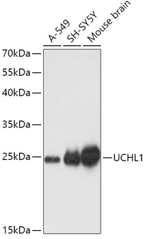 Anti-UCHL1 Antibody (CAB0148)