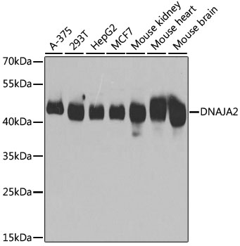 Anti-DNAJA2 Antibody (CAB7059)