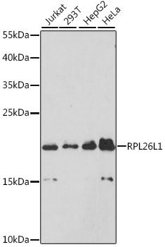 Anti-RPL26L1 Polyclonal Antibody (CAB9192)