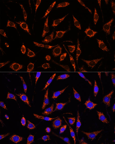 Anti-XK Antibody (CAB15109)