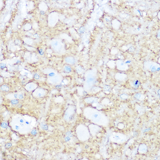 Anti-NCAM1 / CD56 Antibody (CAB7913)