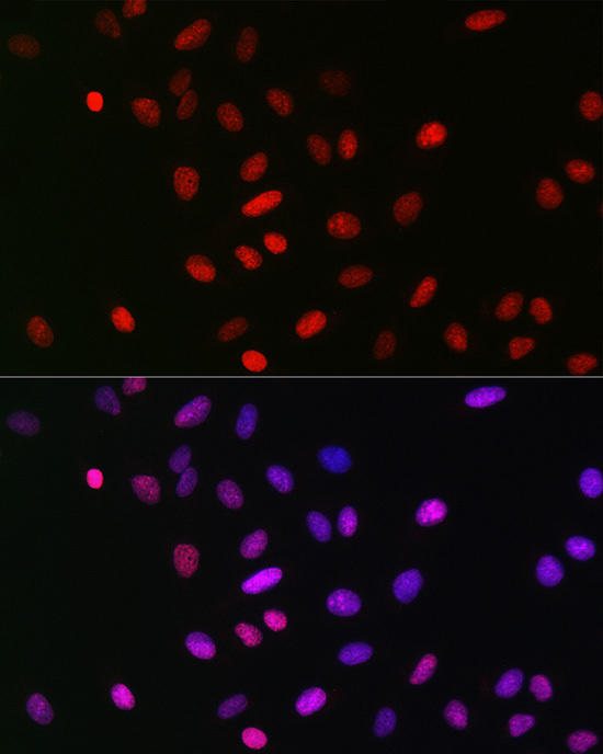 Chromatin immunoprecipitation analysis of extracts of HeLa cells, using MonoMethyl-Histone H3-K18 antibody and rabbit IgG. The amount of immunoprecipitated DNA was checked by quantitative PCR. Histogram was constructed by the ratios of the immunoprecipitated DNA to the input.