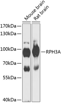 Anti-RPH3A Antibody (CAB13584)