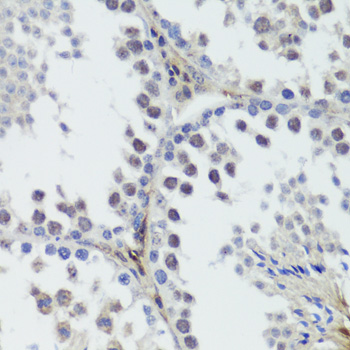 Anti-Phospho-MAPK14-Y182 Antibody (CABP0057)