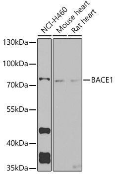 Anti-BACE1 Antibody (CAB5266)