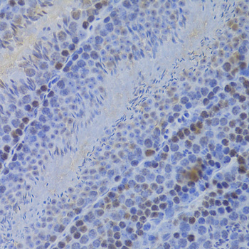 Anti-HELLS Antibody [KO Validated] (CAB5831)