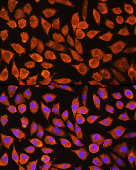 Anti-PDXP Antibody (CAB17455)