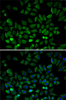 Anti-CDK4 Antibody (CAB0366)