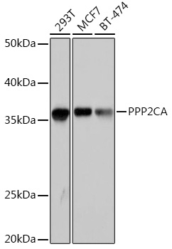 Anti-PPP2CA Antibody (CAB6702)