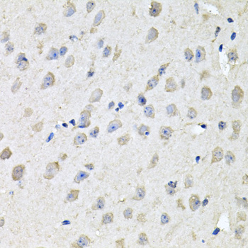 Anti-CHCHD3 Polyclonal Antibody (CAB8584)