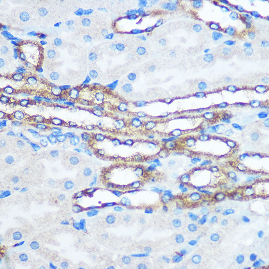 Anti-PKM Antibody (CAB13905)