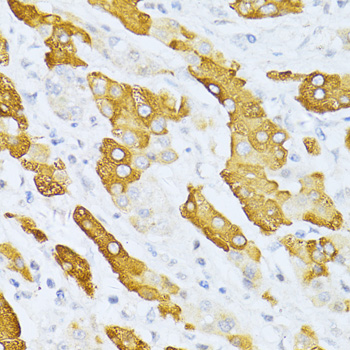 Anti-CYP2E1 Antibody (CAB2160)