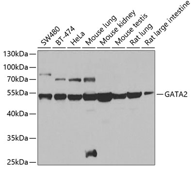 Anti-GATA2 Antibody (CAB0677)