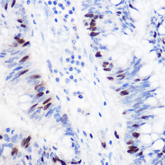 Anti-GMNN Antibody (CAB5316)