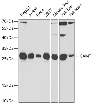 Anti-GAMT Antibody (CAB6597)