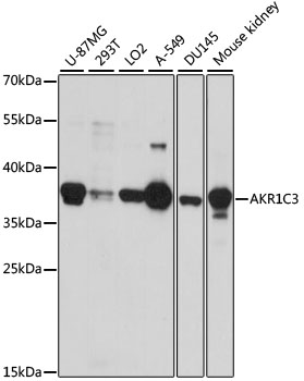 Anti-AKR1C3 Antibody (CAB1781)