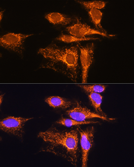 Anti-AMPD1 Antibody (CAB3584)