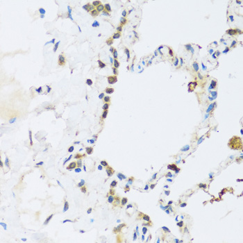 Anti-ATP2A3 Antibody (CAB14232)