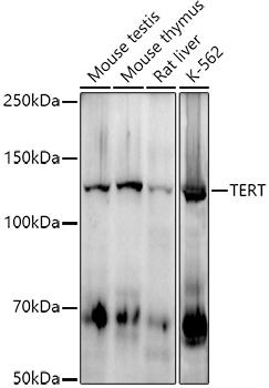 Western blot analysis of extracts of various cell lines, using at 1:1000 dilution. Secondary antibody: HRP Goat Anti-Rabbit IgG (H+L) at 1:10000 dilution. Lysates/proteins: 25ug per lane. Blocking buffer: 3% nonfat dry milk in TBST. Detection: ECL Enhanced Kit. Exposure time: 180s.