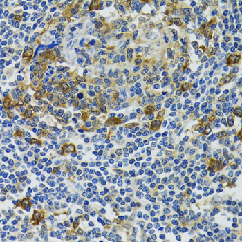 Anti-HSPH1 Antibody (CAB6622)